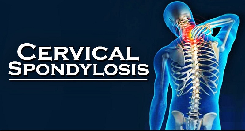 Cervical Spondylosis Treatment in Kandivali