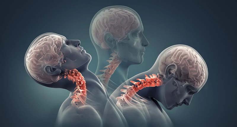 Craniovertebral Junction Spine Treatment in Kandivali, Mumbai