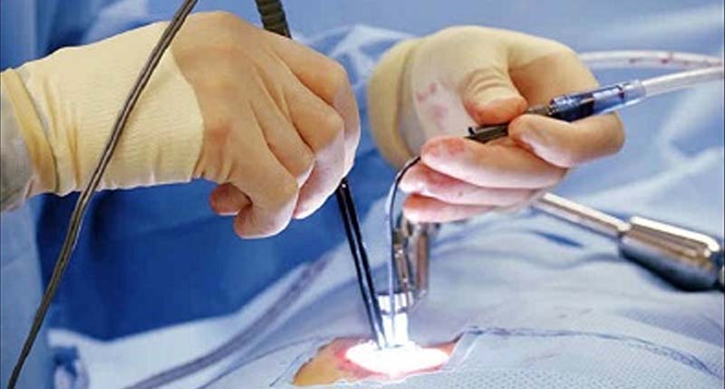 Top Minimally Invasive Surgery Treatment in Kandivali