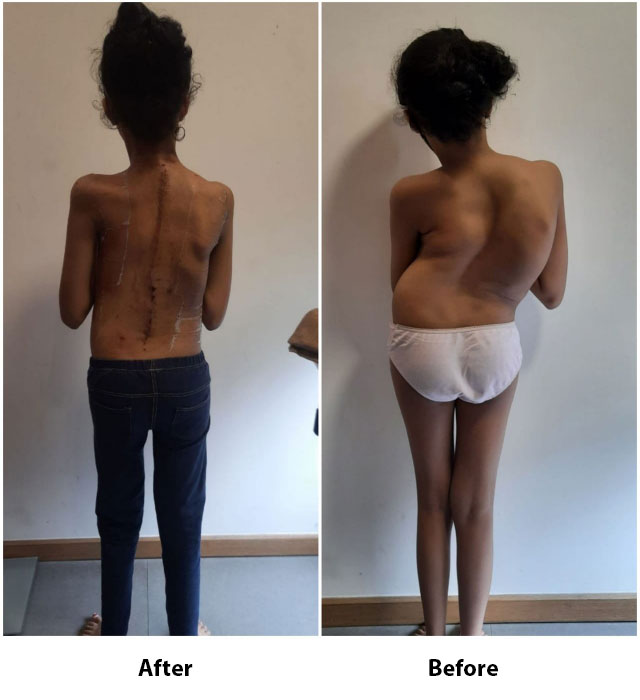 Spine Care Gallery of Dr. Yash Shah