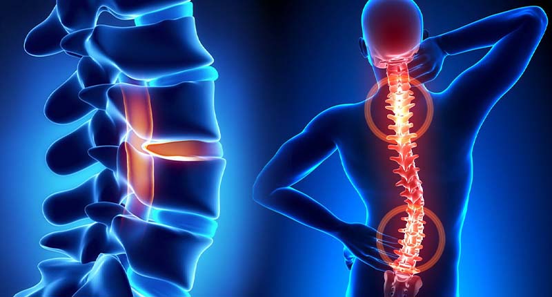 Spinal Trauma Treatment in Kandivali, Mumbai